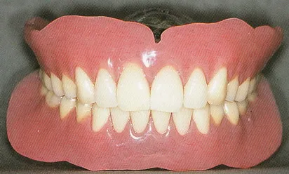 「差し歯・入れ歯」専門医による診療を受けてみませんか?02