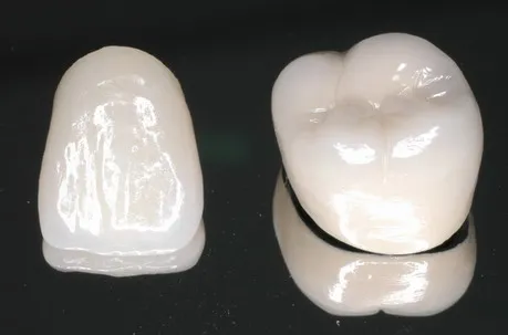 「差し歯・入れ歯」専門医による診療を受けてみませんか?01