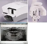 体に優しく、説明がわかりやすいX線撮影